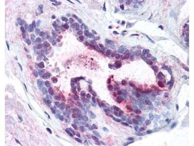 Immunohistochemistry: PDCD4 [p Ser457] Antibody [NB110-60014]